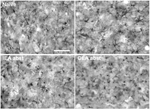 Differential response of glial fibrillary acidic protein-positive astrocytes in the rat prefrontal cortex following ethanol self-administration.